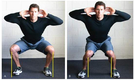 what-your-knees-should-not-be-doing-during-a-squat1.png