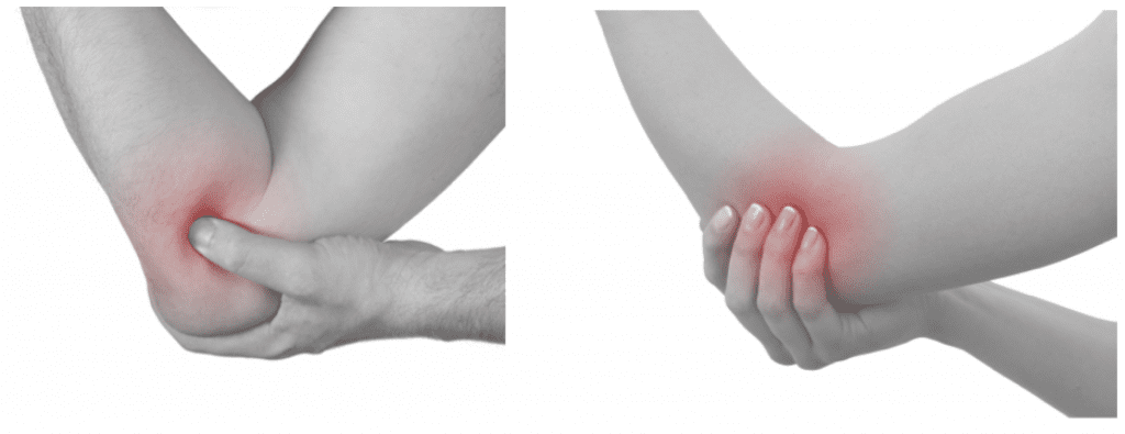 elbow pain 1024x395 Tennis and golfers elbow: Understanding and treating epicondlylitis.