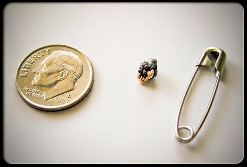 Three things you never want in your kidneys: a dime, a kidney stone, and a safety pin